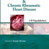 Acute Rheumatic Fever and Chronic Rheumatic Heart Disease (Epub + Converted PDF)