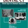 Dental CT: Third Eye in Dental Implants (Original PDF from Publisher)