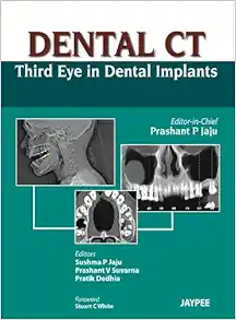 Dental CT: Third Eye in Dental Implants (Original PDF from Publisher)