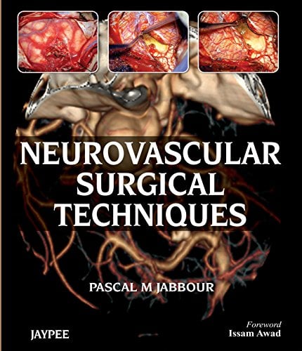 Neurovascular Surgical Techniques (High Quality Image PDF+Converted PDF)