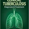 Clinical Tuberculosis: Diagnosis & Treatment: Diagnosis and Treatment (Original PDF from Publisher)