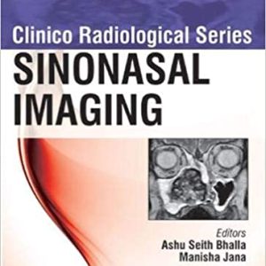 Sinonasal Imaging (Clinico Radiological Series) (Original PDF from Publisher)