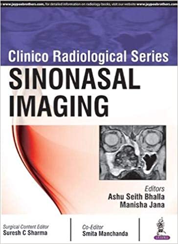 Sinonasal Imaging (Clinico Radiological Series) (Original PDF from Publisher)