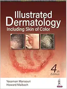Illustrated Dermatology, 4th Edition (EPUB)