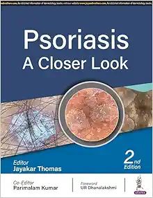 Psoriasis: A Closer Look, 2nd Edition (EPUB)