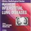Clinico Radiological Series: Imaging of Interstitial Lung Diseases, 2nd edition (Original PDF from Publisher)