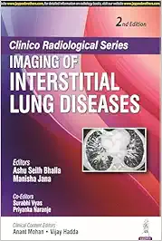 Clinico Radiological Series: Imaging of Interstitial Lung Diseases, 2nd edition (Original PDF from Publisher)