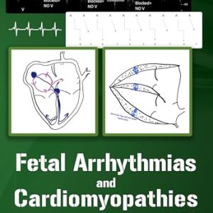 Fetal Arrhythmias and Cardiomyopathies – simplified (AZW3 + EPUB + Converted PDF)