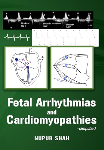 Fetal Arrhythmias and Cardiomyopathies – simplified (AZW3 + EPUB + Converted PDF)