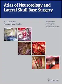 Atlas of Neurotology and Lateral Skull Base Surgery (Original PDF from Publisher)