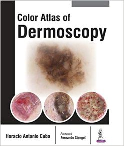 Color Atlas of Dermoscopy (Original PDF from Publisher)