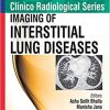 Imaging of Interstitial Lung Diseases (Clinico Radiological) (Original PDF from Publisher)