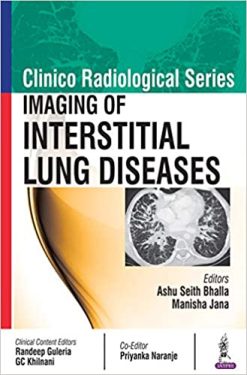 Imaging of Interstitial Lung Diseases (Clinico Radiological) (Original PDF from Publisher)