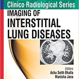 Imaging of Interstitial Lung Diseases (Clinico Radiological) (Original PDF from Publisher)