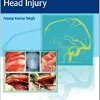 Surgical Nuances of Head Injury (Original PDF from Publisher)