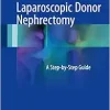 Laparoscopic Donor Nephrectomy: A Step-by-Step Guide (Original PDF from Publisher)