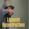 Ligament Reconstructions (World Scientific Series: from Biomaterials Towards Medical Devices, 3) (EPUB)