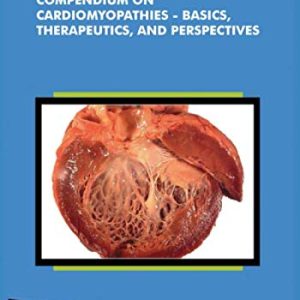 Compendium on Cardiomyopathies – Basics, Therapeutics, and Perspectives (Original PDF from Publisher)