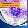 Tuberculosis: a clinical practice guide (EPUB)