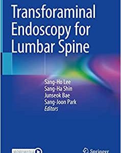 Transforaminal Endoscopy for Lumbar Spine (EPUB)