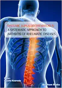 Systemic Lupus Erythematosus: A Systematic Approach to Arthritis of Rheumatic Diseases (EPUB)