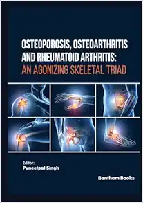 Osteoporosis, Osteoarthritis and Rheumatoid Arthritis: An Agonizing Skeletal Triad (Original PDF from Publisher)