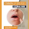 Common Lip Diseases: A Clinical Guide (Original PDF from Publisher)