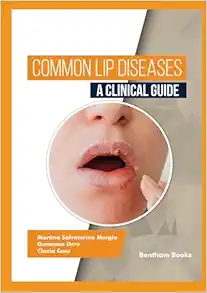 Common Lip Diseases: A Clinical Guide (Original PDF from Publisher)