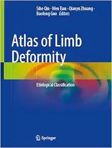 Atlas of Limb Deformity: Etiological Classification (EPUB)