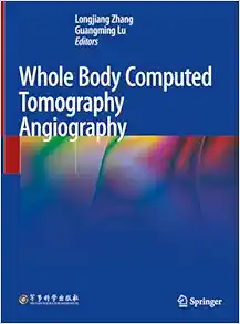 Whole Body Computed Tomography Angiography (EPUB)