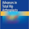Advances in Total Hip Arthroplasty (EPUB)