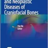Inflammatory and Neoplastic Diseases of Craniofacial Bones (Original PDF from Publisher)