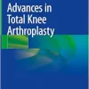 Advances in Total Knee Arthroplasty (Original PDF from Publisher)