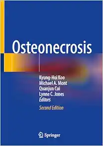 Osteonecrosis, 2nd Edition (EPUB)