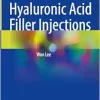 Advances in Hyaluronic Acid Filler Injections (Original PDF from Publisher)