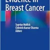 Evidence in Breast Cancer (Original PDF from Publisher)
