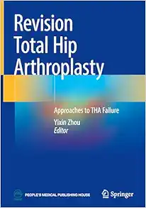 Revision Total Hip Arthroplasty: Approaches to THA Failure (EPUB)