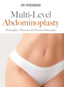 Multi-Level Abdominoplasty: Principles, Practice & Proven Outcomes (Original PDF from Publisher)