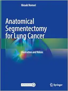 Anatomical Segmentectomy for Lung Cancer: Illustration and Videos (Original PDF from Publisher)