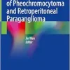 Surgical Management of Pheochromocytoma and Retroperitoneal Paraganglioma (Original PDF from Publisher)