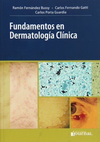 Fundamentos en Dermatologia Clinica (Spanish Edition) (Original PDF from Publisher)