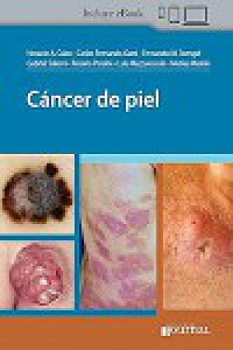 Cáncer de piel (Original PDF from Publisher)