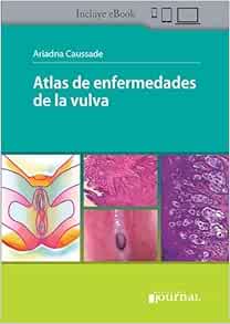 Atlas de enfermedades de la vulva (High Quality Image PDF)