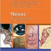 Nevos, Tumores Neviformes y Síndromes Névicos (Spanish Edition) (High Quality Image PDF)