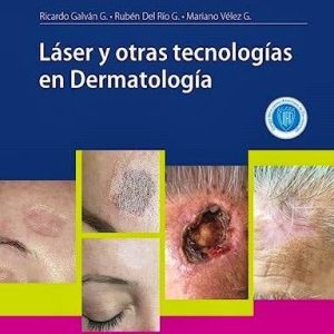 Láser y otras tecnologías en Dermatología (Original PDF from Publisher)