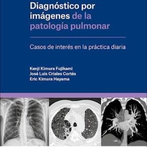 Diagnóstico por Imágenes de la Patología Pulmonar. Casos de Interés en la Práctica Diaria (Original PDF from Publisher)