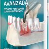 Exodoncia avanzada tecnicas y enfoques clinicos modernos (High Quality Scanned PDF)