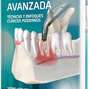 Exodoncia avanzada tecnicas y enfoques clinicos modernos (High Quality Scanned PDF)