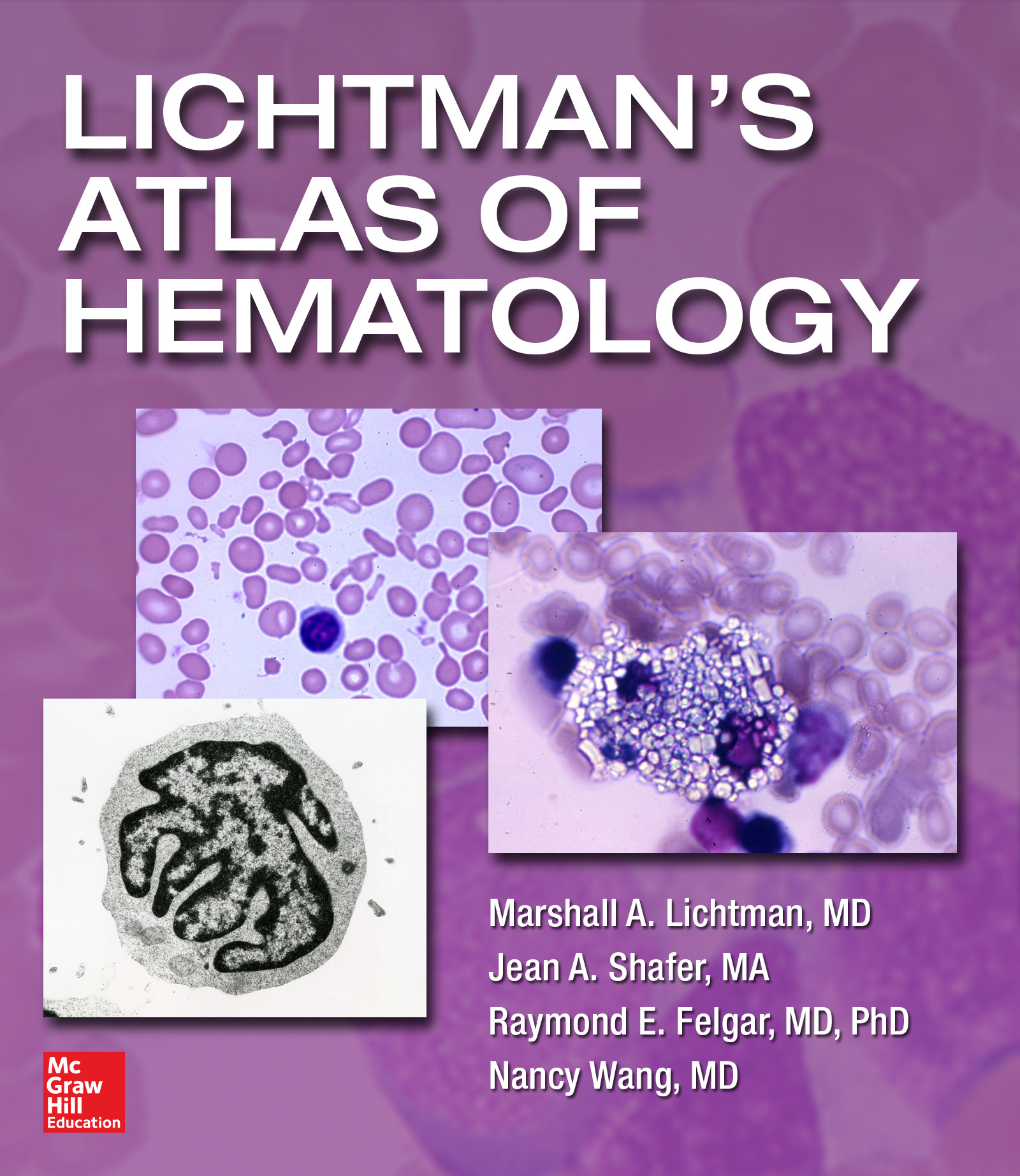 Lichtman’s Atlas of Hematology 2016 (EPUB + Converted PDF)