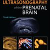 Ultrasonography of the Prenatal Brain, Third Edition (Original PDF from Publisher)